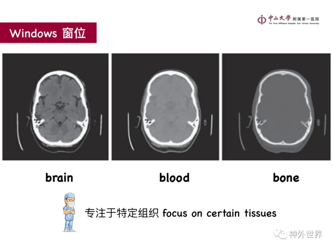 最全影像总结 | 颅内病变 MR、CT 的阅片技巧，太赞了