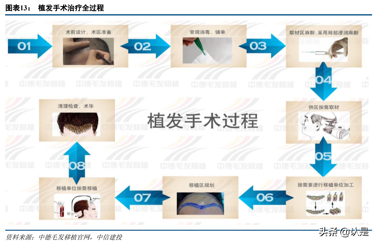 植发行业研究：植发行业前景广阔，龙头连锁抢占先机