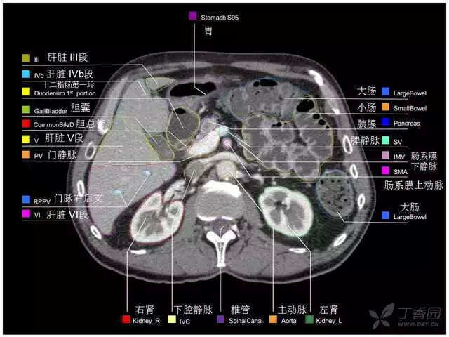 掌握这篇解剖，晋级腹部CT影像诊断高手（精细版）