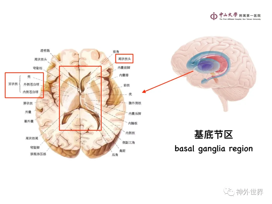 最全影像总结 | 颅内病变 MR、CT 的阅片技巧，太赞了