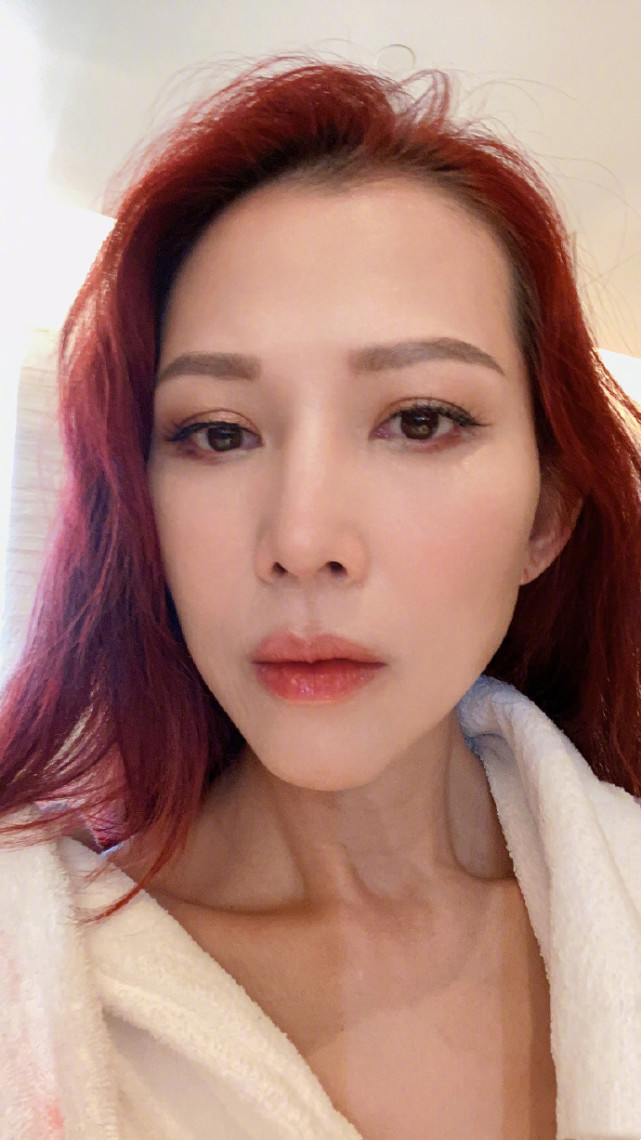 蔡少芬曬懟臉拍鎖骨搶鏡，在線詢問早起嘴腫原因，被侃：張晉親的