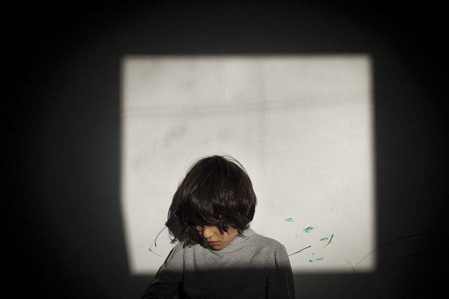 自閉症患者：在出生前的神經細胞有所不同