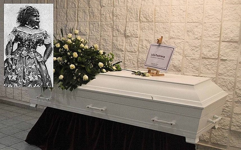 她被称为最丑女人，一生因奇特长相被当摇钱树