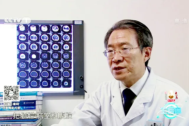 尽力帮助脑积水患者早日解除病痛-记航空总医院神外专家肖庆