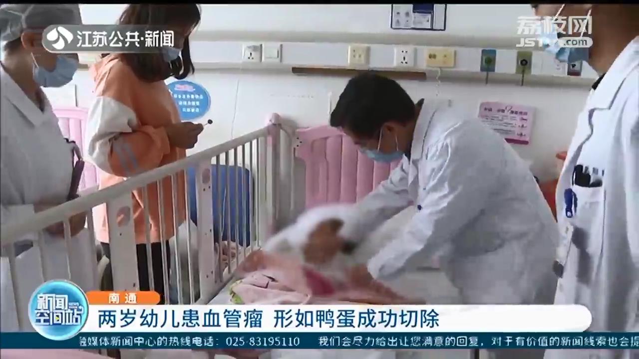 两岁幼儿左胸壁长鸭蛋大小血管瘤 医生妙手成功切除