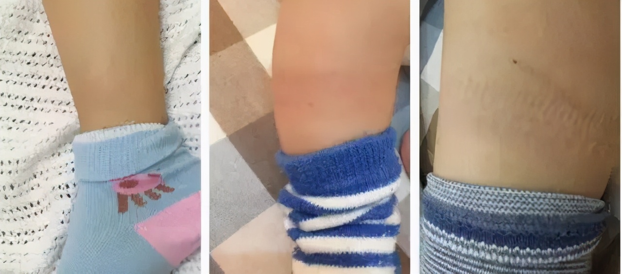 宝宝秋冬睡觉要不要穿袜子？宝宝袜子该怎么选？