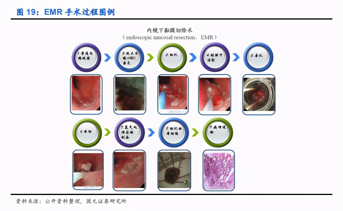 内镜诊疗器械行业深度报告：聚焦高端，着眼全球