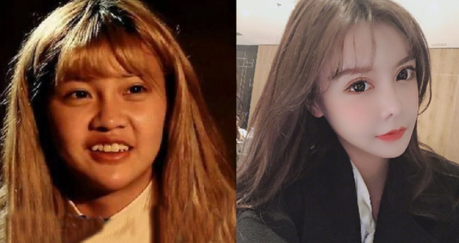 baby戴眼罩鼻子挤压变形，鼻梁形状暴露是否原装