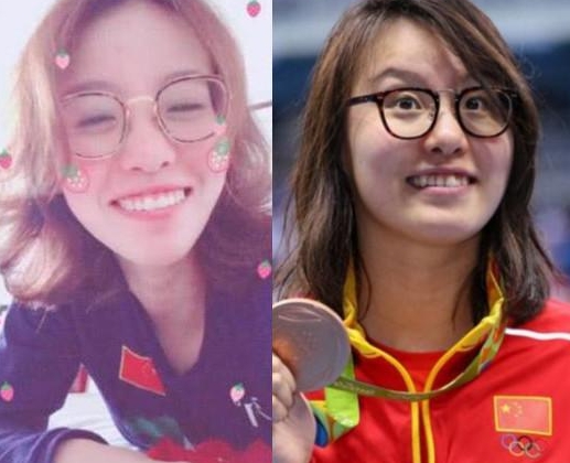 有种“整容”叫傅园慧，整完牙后判若两人，网