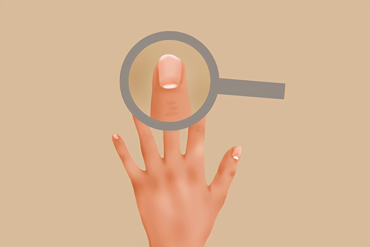 指甲上出現豎紋，是咋回事？ 月牙的多少，與健康有關？