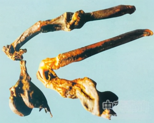 四肢怕冷，被稱為陽虛的人，冬天更明顯！ 除了保暖，還要知道這些