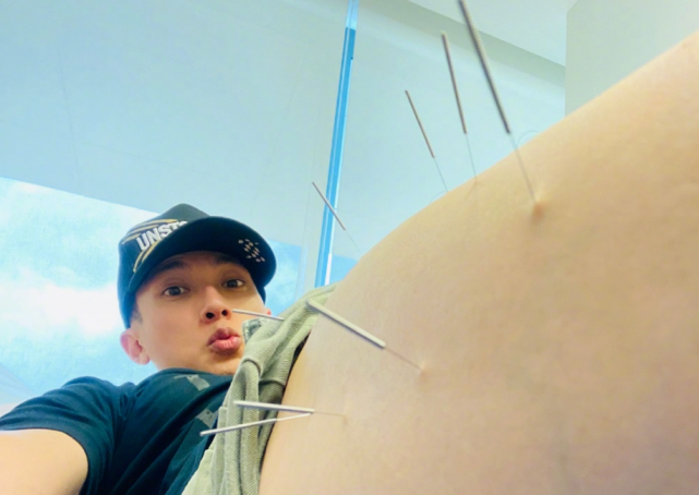 吴尊打篮球受伤，晒腿部针灸照自侃英雄变狗熊，看着害怕又心疼