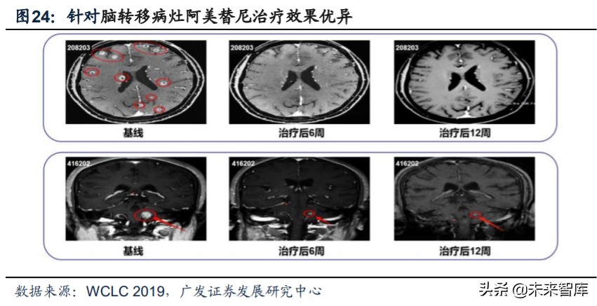 医药行业专题：第三代EGFR-TKI药物，第一大癌症造