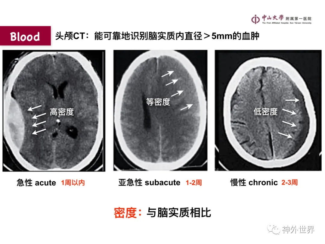 最全影像总结 | 颅内病变 MR、CT 的阅片技巧，太赞了