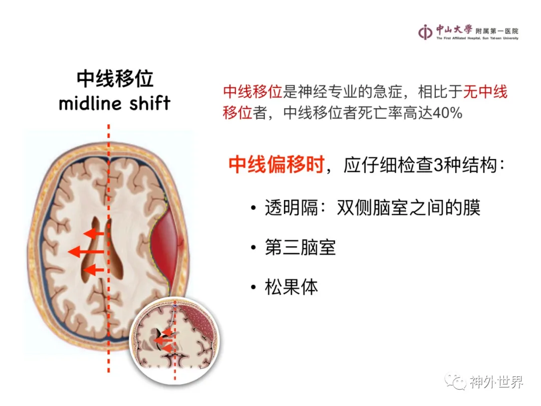 最全影像总结 | 颅内病变 MR、CT 的阅片技巧，太赞了