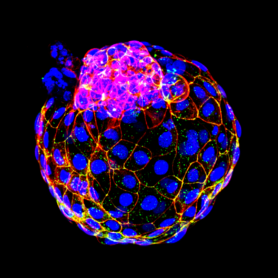 全球最完整人类胚胎模型诞生，将给发育生物学带来变革性推动