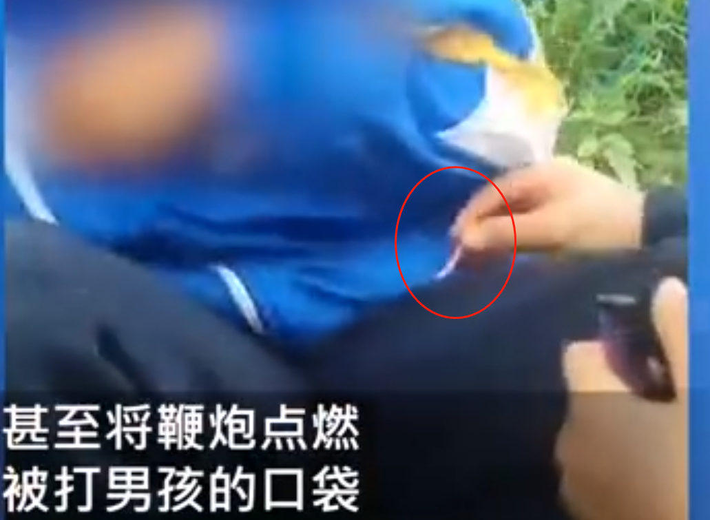 『衣服』小学生遭欺凌衣服被塞鞭炮 校园欺凌再次成为热议话题