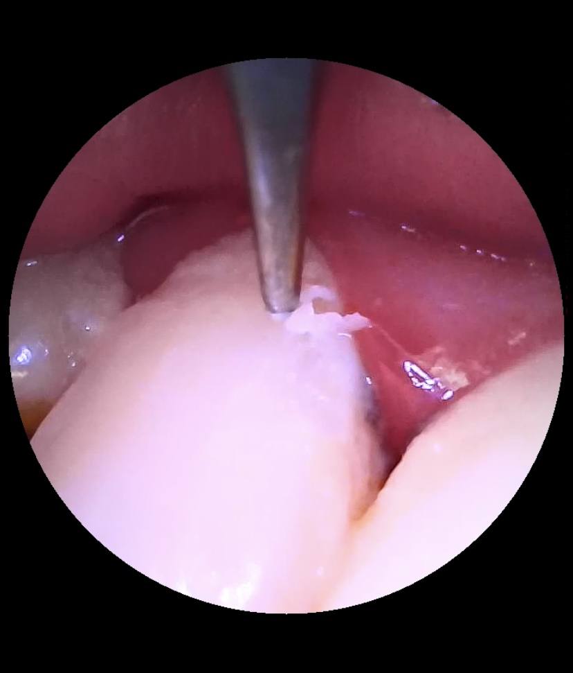 谁说牙齿不能做SPA-素诺智能可视超声波洁牙仪体验