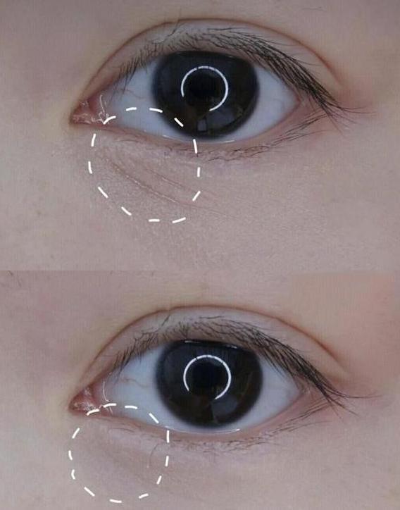 继