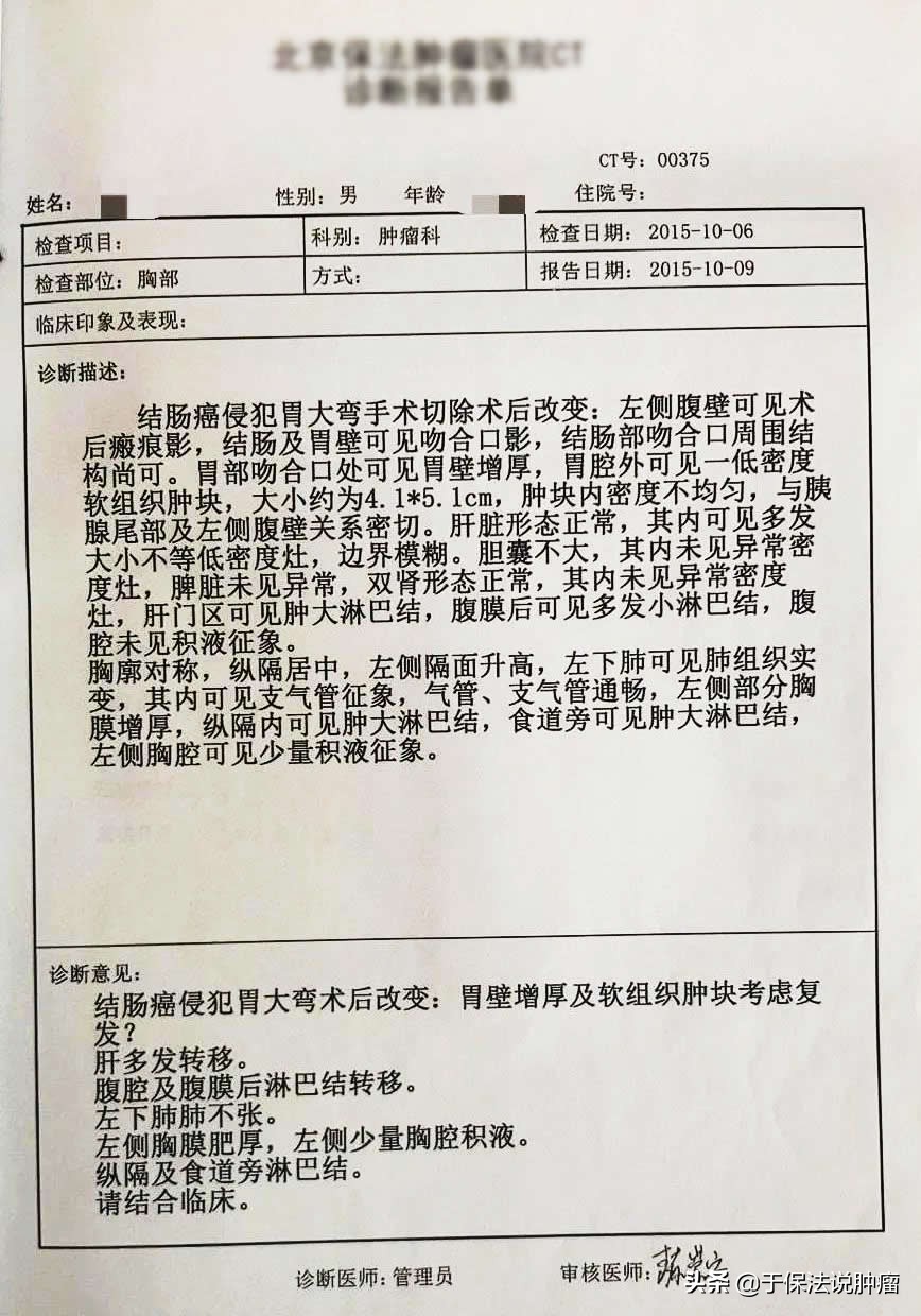 结肠癌术后肝转移患者，接受缓释库治疗后好转