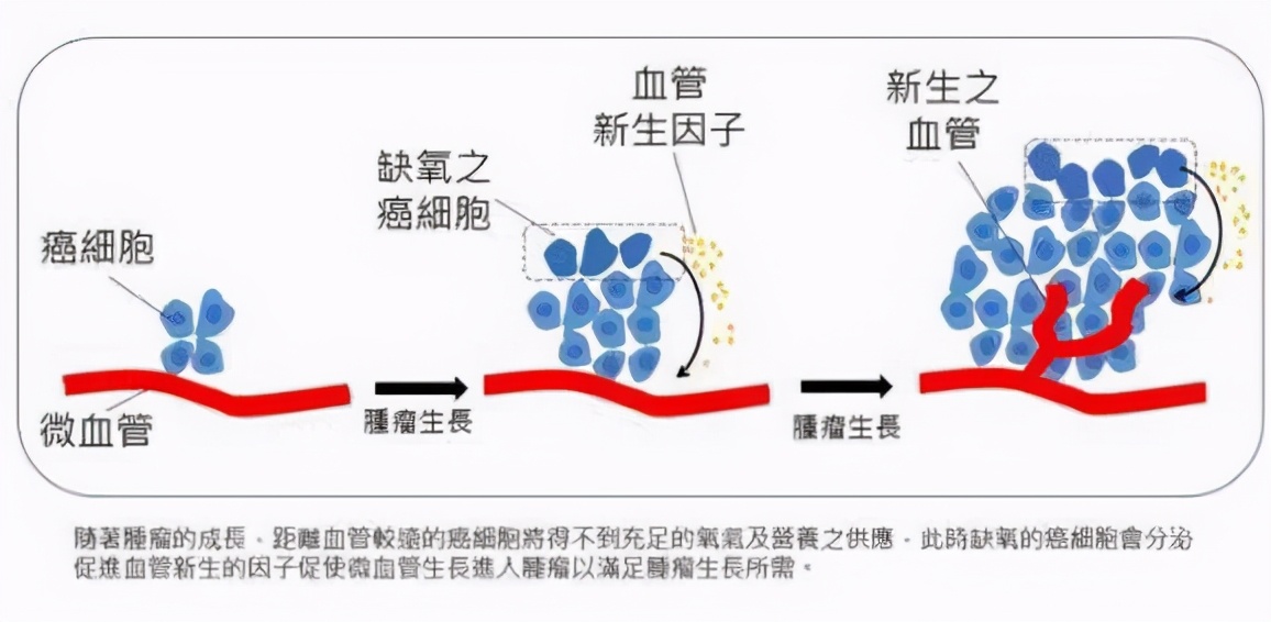 肿瘤，可以培养的比恐龙还大吗？