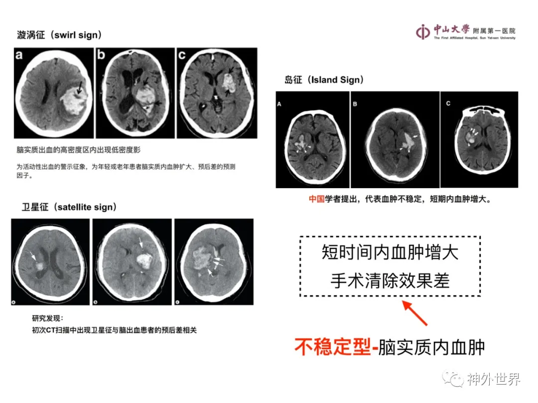 最全影像总结 | 颅内病变 MR、CT 的阅片技巧，太赞了