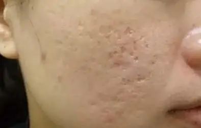 坑坑洼洼，把被“坑过”的青春要回来！免费送10个“填坑”名额啦！