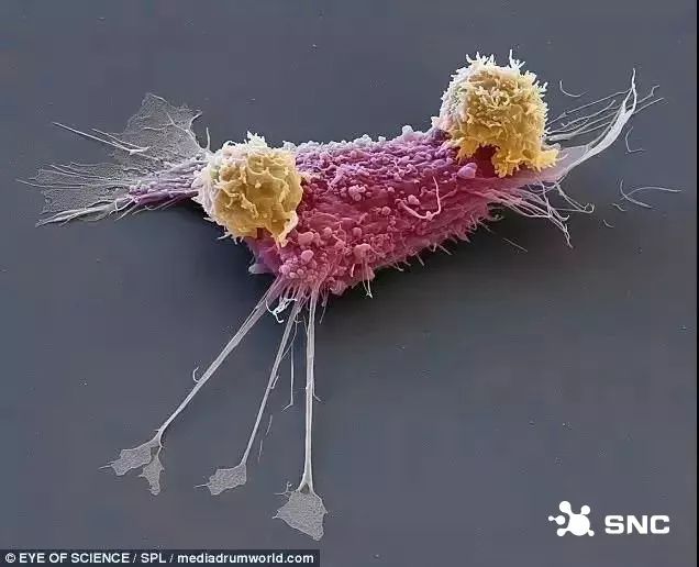 免疫细胞是如何消灭癌细胞？微观世界下的震撼战争