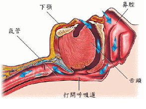 赵本山的老搭档死于窒息！打呼噜的人，安眠药真不能随便吃