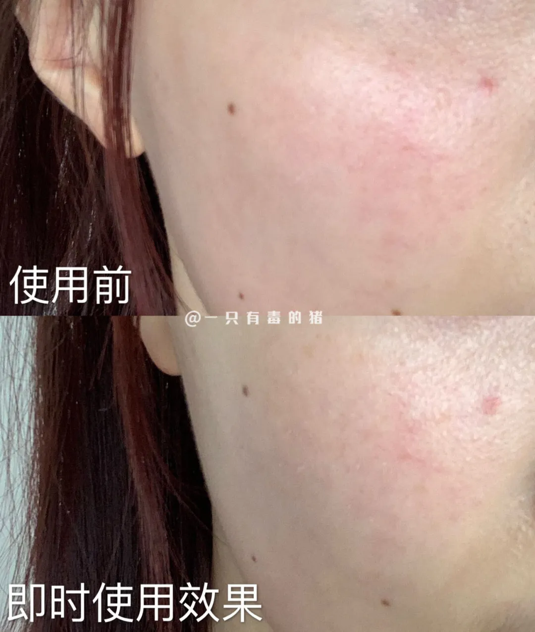 认真的吗?金晨居然用啤酒敷脸