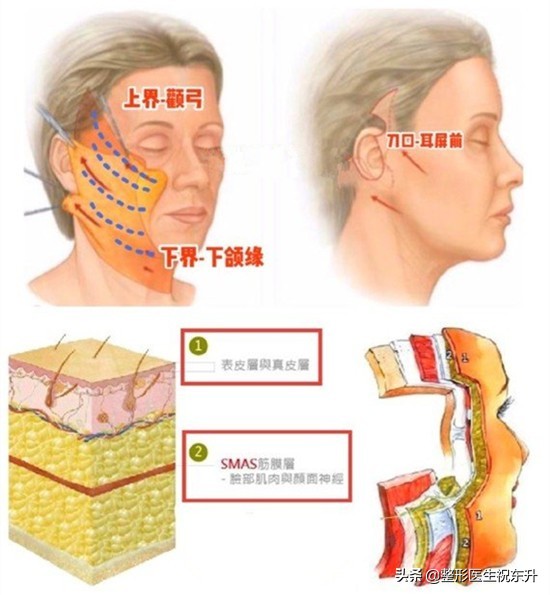 扒一扒“小拉皮和大拉皮”的区别