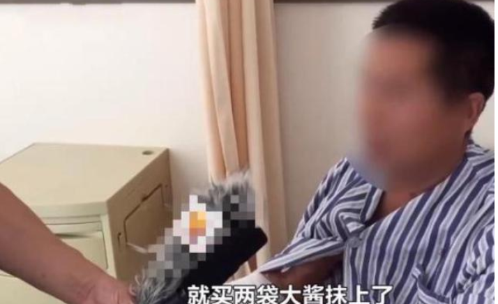 先抹|大爷烧伤后先抹盐水后抹大酱 网友：你腌肉呢？