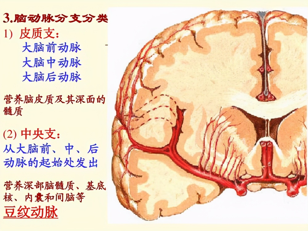 动脉硬化伴皮质下梗死及白质脑病 常见白血管病变 肌内动脉病变 Mp头条