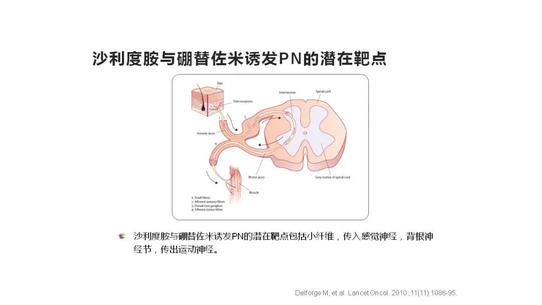 “中老年人腰背痛需警惕多发性骨髓瘤”健康大课堂