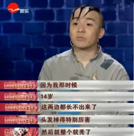 “三毛”长大了！8岁成名，14岁秃顶，34岁变帅哥