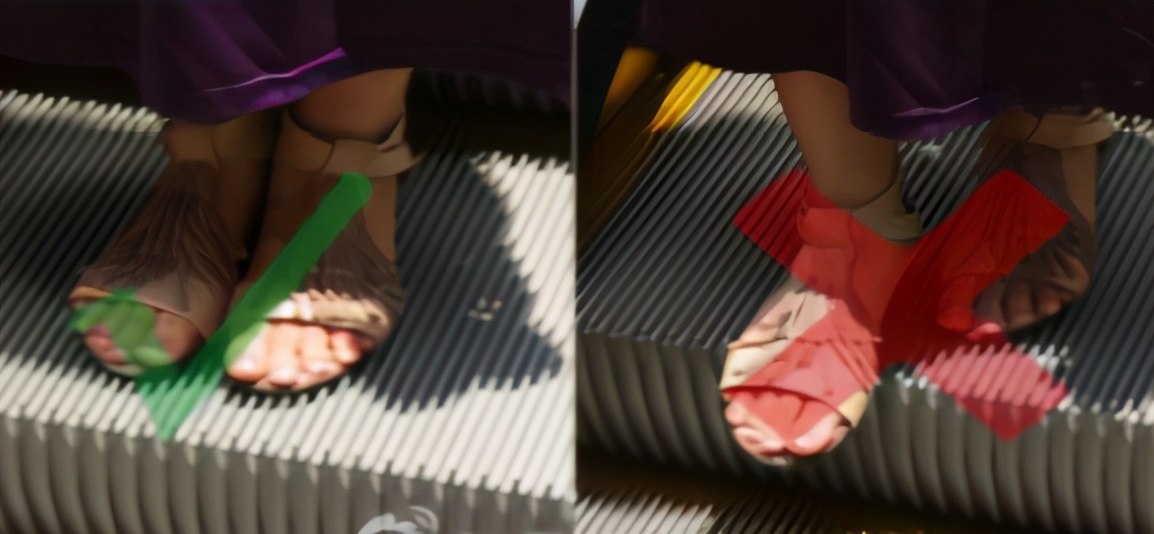 痛心，上海3岁男孩乘自动扶梯夹断脚掌，怎么教育孩子正确乘梯