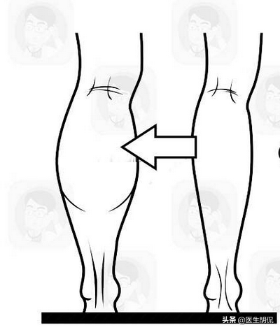腎衰竭並非悄無聲息！ 晨起3種異常，警惕腎臟求救，別視而不見