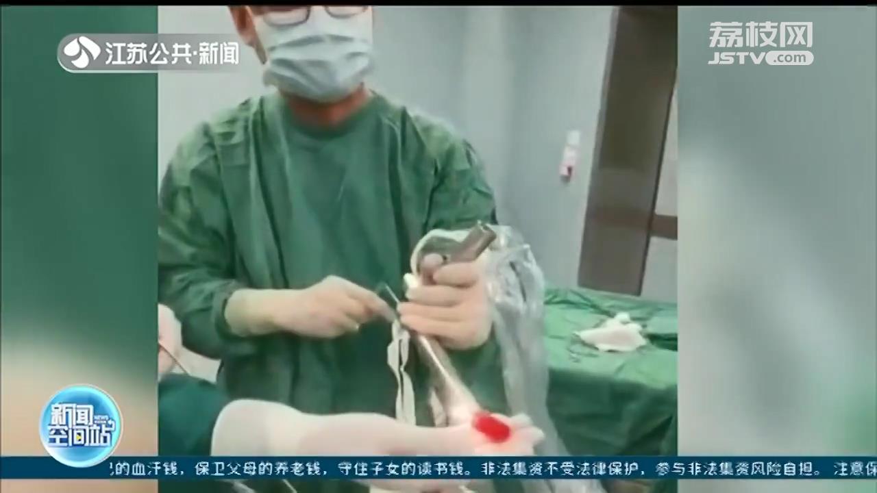 常州少年喝冰可乐，瓶盖意外卡进食管 全麻手术后取出