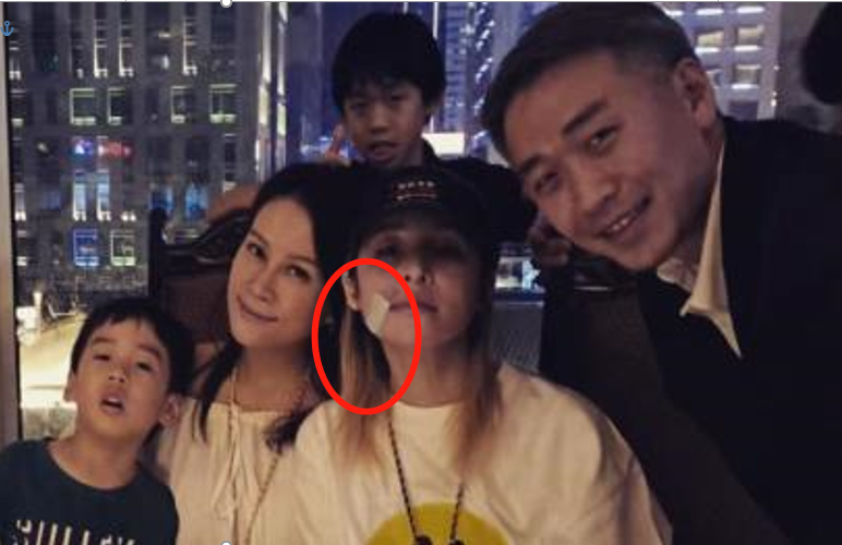 知名歌手曹格被自家狗咬伤，地板上全是血渍，爱犬腿部残疾脾气差