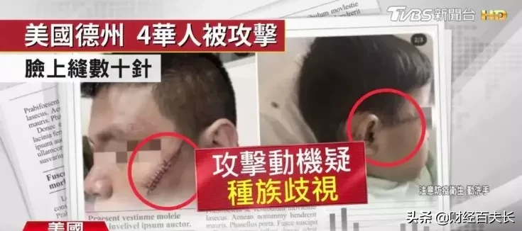 警察直播杀黑人，不止是种族歧视的问题吧？