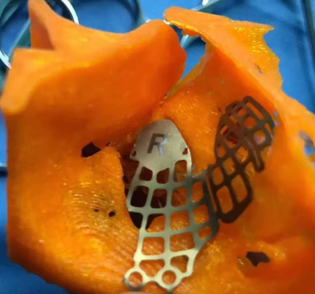 沈阳市卫生健康系统"人才建设年、科技创新年、基层提升年"建设成果之沈阳爱尔眼视光医院工作纪实