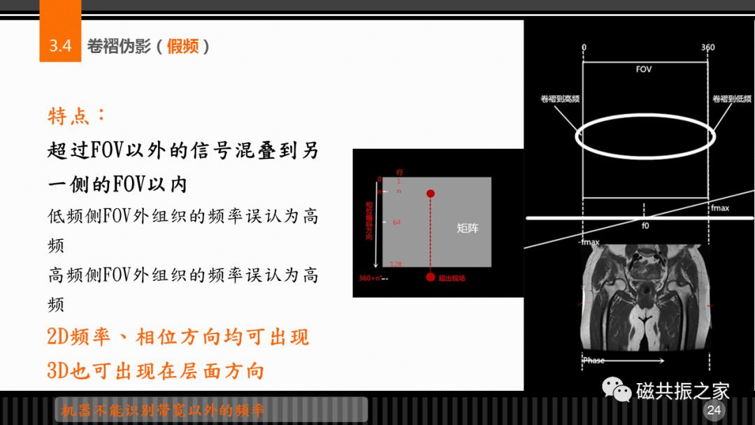 磁共振常见伪影及策略