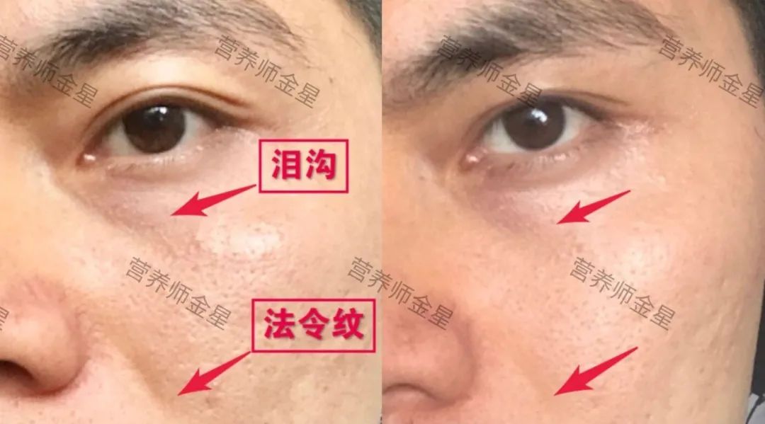 胶原蛋白是&ldquo;智商税&rdquo;吗？我不这么认为