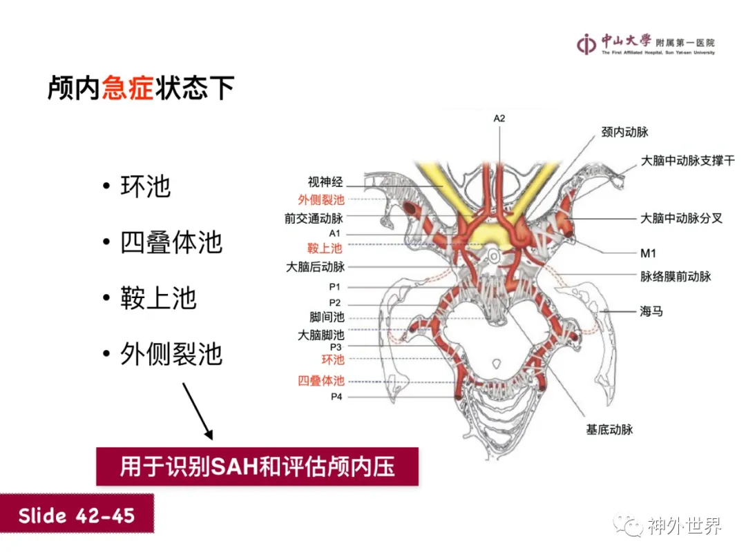 最全影像总结 | 颅内病变 MR、CT 的阅片技巧，太赞了