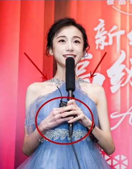 5位瘦成皮包骨的明星，不分男女的减肥，当真要钱不要命？