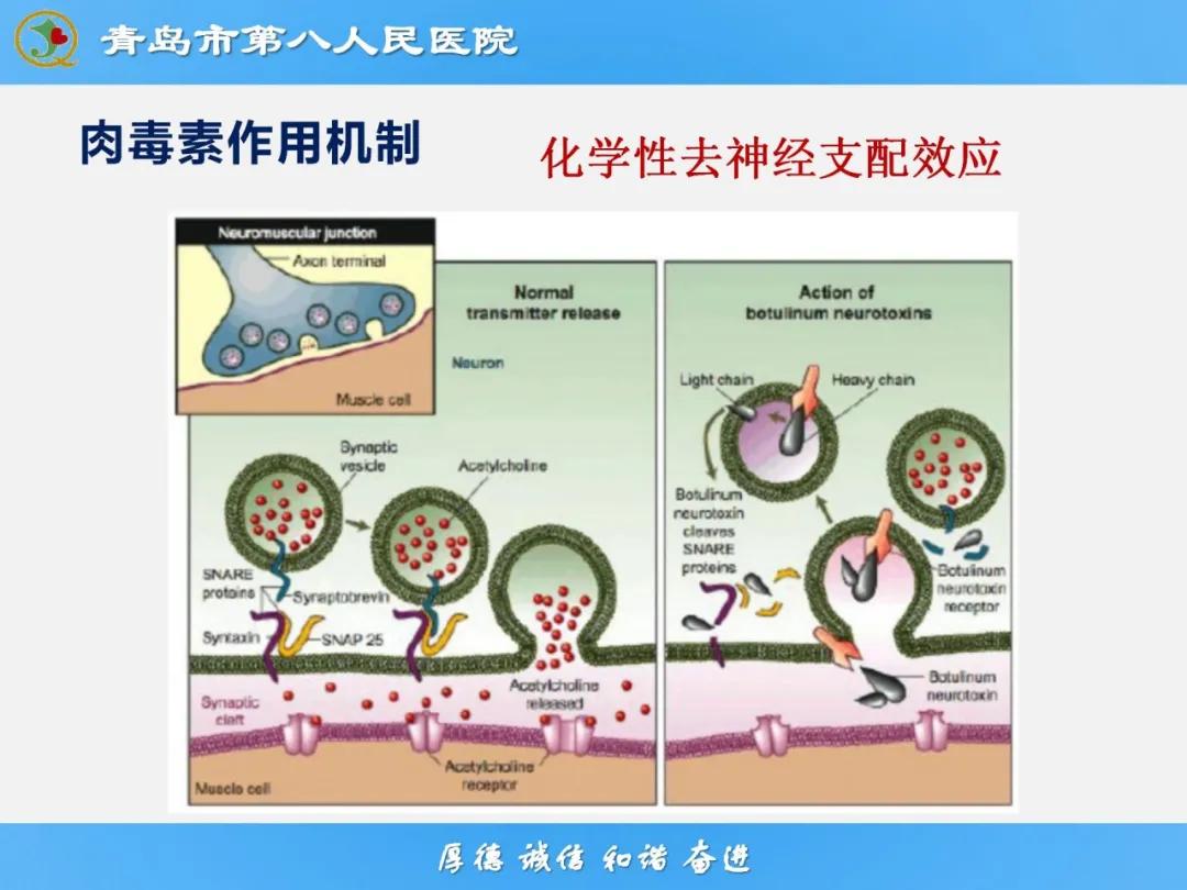 健康科普大赛获奖作品展示⑭丨肉毒毒素微整注射