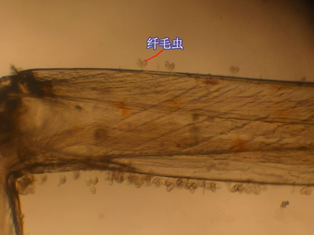 南美白对虾养殖中容易忽视的寄生虫病—纤毛虫病