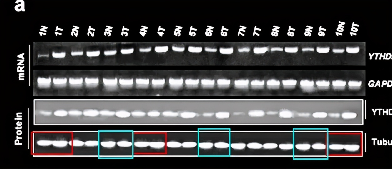 山东滨州医学院附属医院11篇SCI文章"挂榜"PubPeer