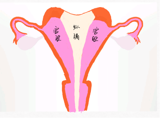 宫体中央见一低回声带,宽约11mm,将内膜分成两部分,并延续至宫颈外口