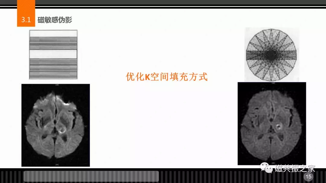 磁共振常见伪影及策略
